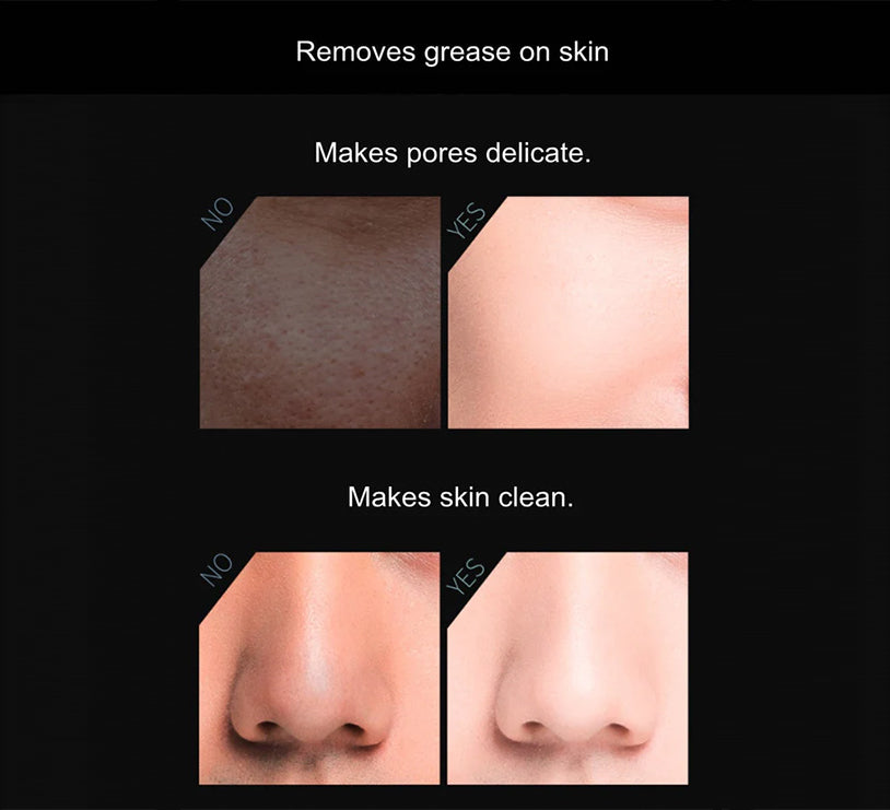Innovative Volcanic Stone Oil-Absorbing Face Roller | Instant Matte Finish | Reusable | Makeup-Friendly | 2 inch